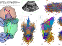 暗网禁区
倪东教授团队在《Medical Image Analysis》上发表文章