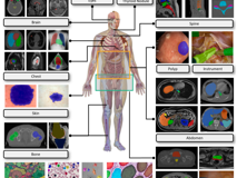 暗网禁区
倪东教授团队在《Medical Image Analysis》上发表文章